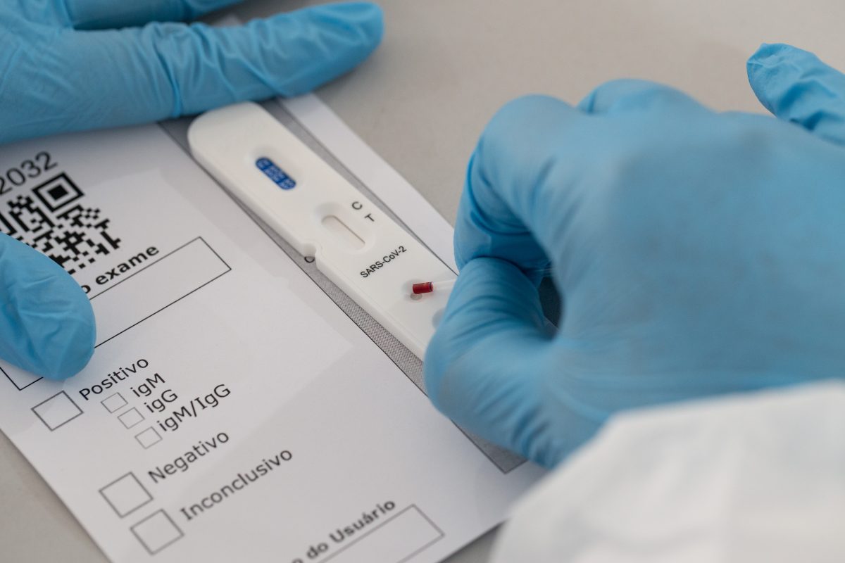 Prefeitura lança pregão eletrônico para compra de testes rápidos para detecção de Covid-19
